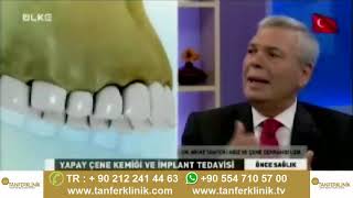 implant nedir  Çene Kemiği erimesinde implant yapılır mi TanferKlinik [upl. by Virginia]