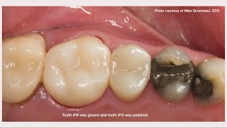 Zirconia 101 2 of 11 What is KATANA Zirconia [upl. by Nahtonoj]