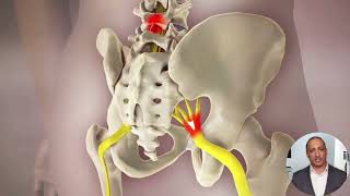 What is Endoscopic Rhizotomy [upl. by Yahsan202]