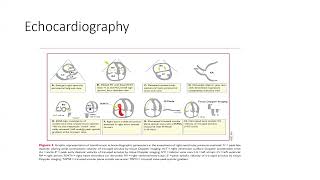 Pulmonary Embolism [upl. by Trautman783]