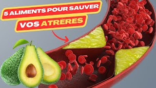 5 aliments pour sauver vos artères  maladie cardiaque  crise cardiaque  cardiac catheterization [upl. by Chrissa]