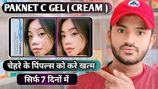 Paknet c gel uses dose benefits and Side effects full review in hindi [upl. by Waers299]