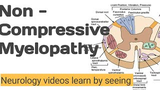 NON Compressive myelopathy  Neurology videos learn by seeing [upl. by Eikcor]