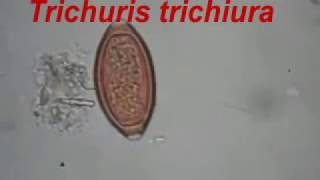 Trichuris trichiura and Ascaris lumbricoides [upl. by Naahs786]