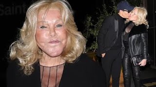 Jocelyn Wildenstein Catwoman dévoile un cliché delle jeune avant sa transformation cest choqu [upl. by Evaleen]