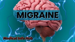 Migraine Headache Relief Migraine ka ilaj Migraine symptoms Migraine painMigraine [upl. by Adamek]