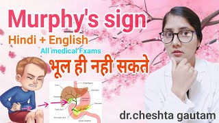 Murphys sign in hindi [upl. by Enoid648]