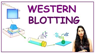 WESTERN BLOTTING I Protein Detection I Tools amp Technique I Methods in Biology [upl. by Airdnazxela]