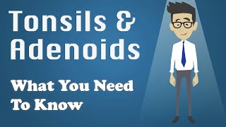 Tonsils and Adenoids  What You Need To Know [upl. by Philippe897]