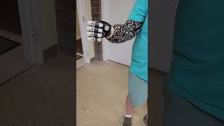 TASKA® Prosthetic Hand with CoApt Pattern Recognition System [upl. by Siddra928]