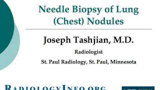 Your Radiologist Explains Needle Biopsy of Lung Chest Nodules [upl. by Gnauq16]