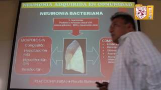 Patología II  Neoplasia Pulmonar [upl. by Gilli902]