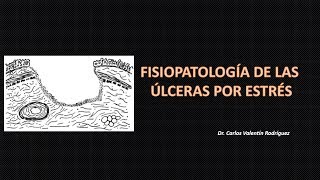 Fisiolopatología de úlceras por estrés DrVale [upl. by Cherianne331]