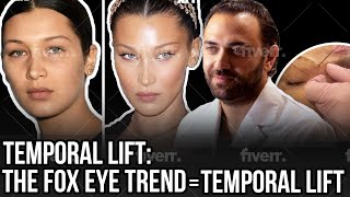 Temporal Brow Lift  Dr Sami Moubayed  FACE MD [upl. by Leidag]