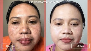 Ella Transformation Klaten [upl. by Nosna]