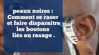 Peau noire Comment bien raser la barbe et surtout éviter les poils incarnés [upl. by Ginevra]