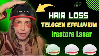 quotThe Ultimate Solution for Hair Regrowth iRestore Elite Laser System Reviewquot [upl. by Shevlo792]