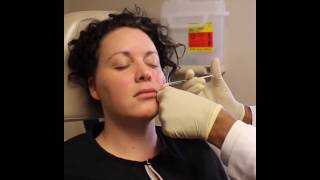 Botox for Rosacea [upl. by Marna]