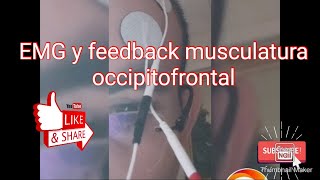 feedback con electromiografia de superficie en musculatura facial [upl. by Mirth]