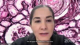 Puntos clave para el diagnóstico de glomerulopatías  GlomConILA [upl. by Alguire]