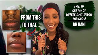 How To Get Rid Of Hyperpigmentation  Dr Hani [upl. by Eyssej]