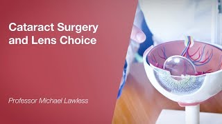 Cataract Surgery and Lens Choice [upl. by Araht]