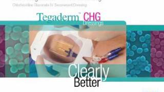 3M™ Tegaderm™ CHG Part 1  Basics [upl. by Doowron55]