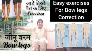 Bow legs correction exercises  जीनू वरम  आड़े तिरछे पैरों के लिए कुछ Exercise  Locked Knees [upl. by Davidson]