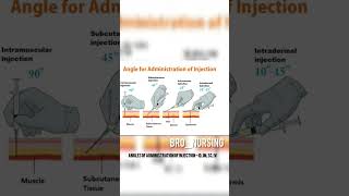 Angles of Administration of Injection  ID IM SC IVadministration injection shortvideo [upl. by Burr]