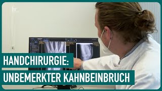 Kahnbeinpseudoarthrose  Experten für heile Hände  55  Die Gesundmacher [upl. by Atteuqihc]