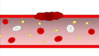 Hemostasis  Helpful Blood Clotting [upl. by Phox]