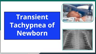 Transient tachypnea of newborn mbbs newbornneonatology neetpg pediatrics nursing ttn [upl. by Ielirol]