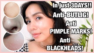 ANTIBUTLIG  ANTIPIMPLE MARKS  ANTIBLACKHEADS ON NOSE  CLEARED SKIN IN JUST 3 DAYS  Kim Tadeo [upl. by Clare]