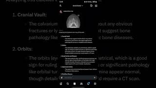 GROK analizes Chest amp Sinus X Rays [upl. by Alice]