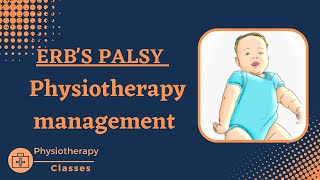 Erbs palsy physiotherapy managementphysical therapy for erbs palsyerbs paralysispt management [upl. by Freddy]