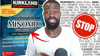 Why I STOPPED USING Minoxidil to Improve my Beard Growth  Dont use Minoxidil Before Watching This [upl. by Eilzel]