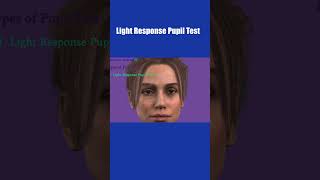 Pupil Examination  RAPD  Pupillary Light Reflex  Marcus Gunn Pupil  Swinging flashlight Test [upl. by Bea]