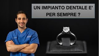 Quanto dura un impianto dentale [upl. by Zzaj847]