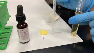 Urinalysis Urine Sediments [upl. by Oiramal]