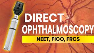 Direct Ophthalmoscopy Tips and Tricks [upl. by Assitruc]