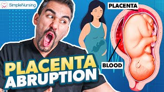 Placental Abruption Symptoms Causes Nursing Interventions  NCLEX Tips [upl. by Nahrut]