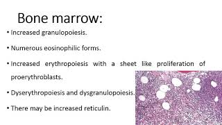 Myeloid lymphoid neoplasms with PCM1 JAK2 [upl. by Ahsimit219]