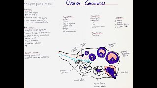 Ovarian Carcinomas  Histology Types Symptoms Diagnosis Risk Factors Treatment Prognosis [upl. by Akinihs]