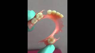 flexible denture made perfectly for you [upl. by Xena]