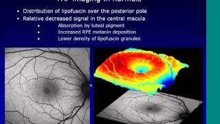 An Overview of BluePeak Autofluorescence and its Use in a Clinical Setting [upl. by Sherburn]