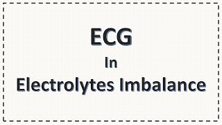 Electrolytes Imbalance and ECG changes  Hypokalemia Hyperkalemia Hypocalcaemia Hypercalcaemia [upl. by Hamachi]