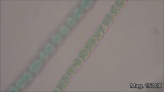 Anabaena under the Microscope [upl. by Alak]