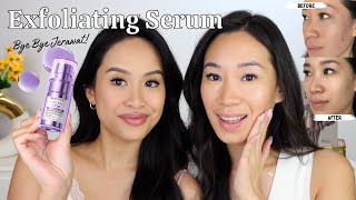 Skin Renewal Exfoliating Serum Bisa Sembuhin Jerawat PMS  Lactic Acid Serum [upl. by Mudenihc]