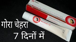 गोरा चेहरा सिर्फ 7 दिनों में Melalite 15 Cream Review Hindi [upl. by Aitercul]