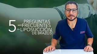 5 Preguntas Frecuentes para Liposucción de Brazos [upl. by Nalepka19]